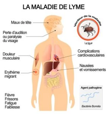 maladie-lyme-symptome